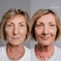 COMBINATIONS OF DIFFERENT AREAS