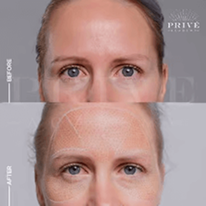 COMBINATIONS OF DIFFERENT AREAS