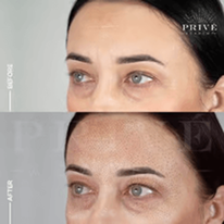 COMBINATIONS OF DIFFERENT AREAS