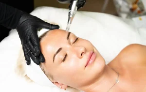 How to Prepare for Plasma Fibroblasting