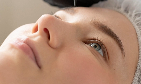 The Plasma Pen Treatment-4