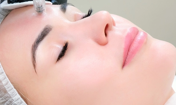 The Plasma Pen Treatment -7