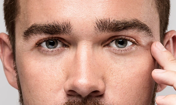 The Plasma Pen Treatment - 8